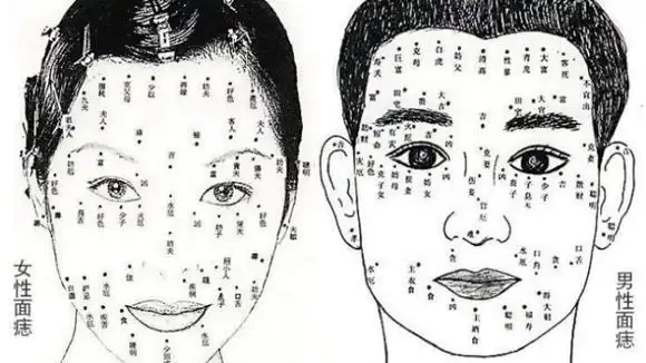 痣相解析:男人身上这几种"克妻痣",不能留,女人们可要看准了-情感视频
