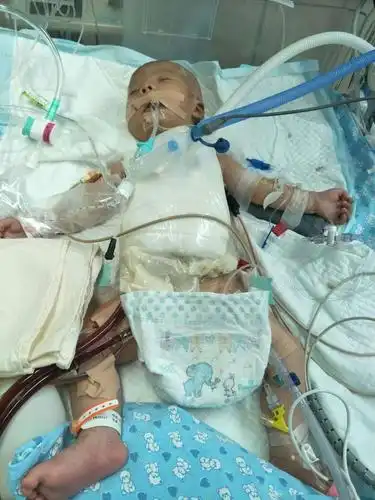 2021年贫困家庭先心病儿童入户回访活动