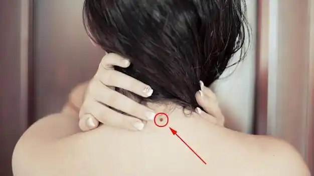 脖子正后方有痣的女人命运好不好?(图解) - pc400