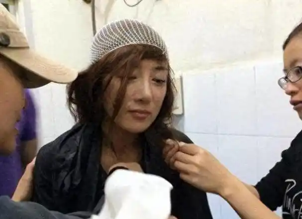 李依晓被誉为古装女神却从被狗咬伤脸今用实力证明自己