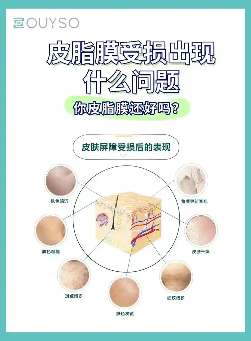 皮脂膜是皮肤的一道"护城河",一旦皮脂膜受 - 抖音