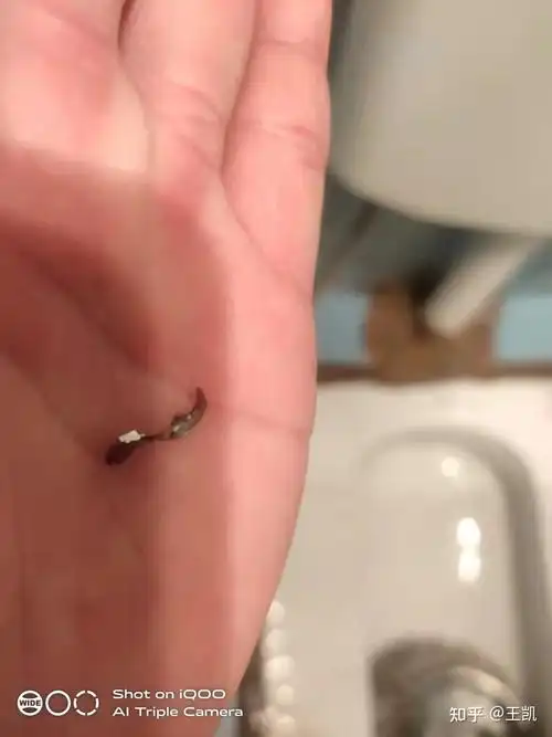 今天下午取出一个钉子,以为还剩一个,于是努力想把它取出,结果发现