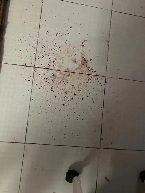 讨论后续外伤有图慎入一觉醒醒来楼梯地板有血