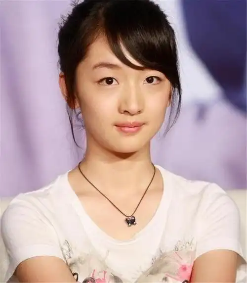 5位割双眼皮的明星戚薇肿了陈学冬换脸而她是医生下手太重