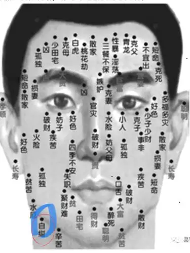 多少人爱屋及乌,把不可污染的脸蛋上一粒鸟屎--病毒疣痣错爱成了金蛋.