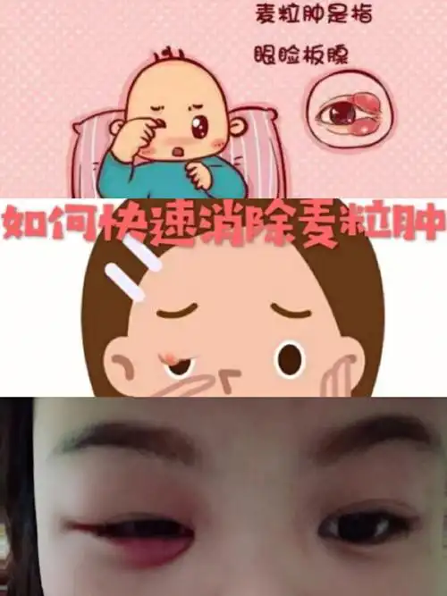 在家休息好几天了,今天麦粒肿终于好了一点 ,想给陈先生做个晚饭