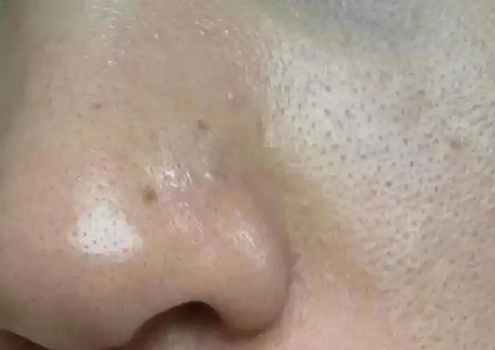 有果必有因看看粗大毛孔怎么出卖你护肤老师萱萱