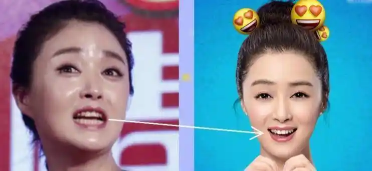 高圆圆之前有龅牙的缺陷,曾经为矫正牙齿息影一年,才有了灿烂的笑容.