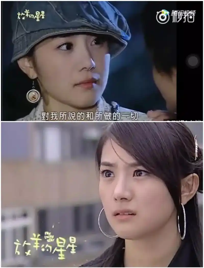 《放羊的星星》女主夏之星也整残了,厚宽双眼皮脸部僵硬到认不出