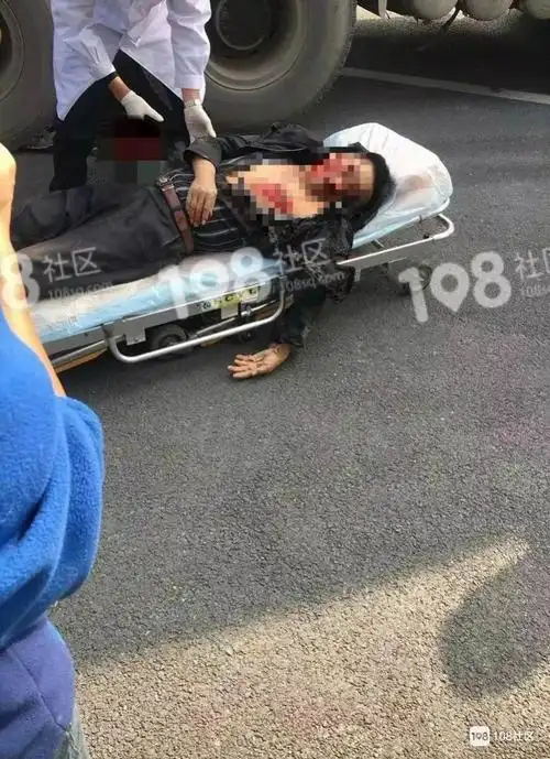 突发车祸猛如虎绍兴大妈斑马线上被撞倒电瓶车大爷脚板生生压没男子遭