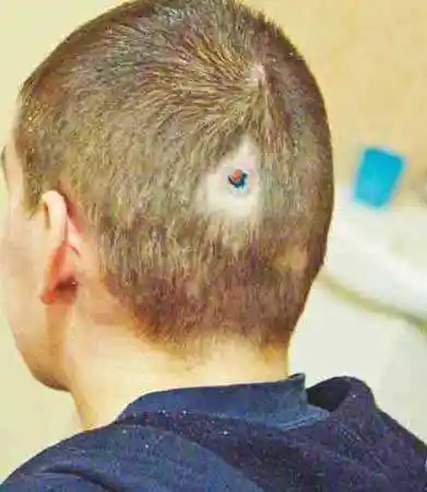 真实记录人中枪后的真实后果影视剧隐瞒了不为人知真相