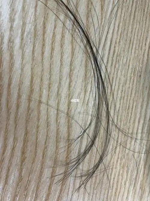 剪下来一缕头发,以后主要看减下来的头发周围这一小片的头发情况不能