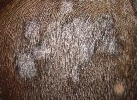 头皮瘙痒,严重脱屑,"白癣"可能是元凶_寻医问药频道_寻医问药网