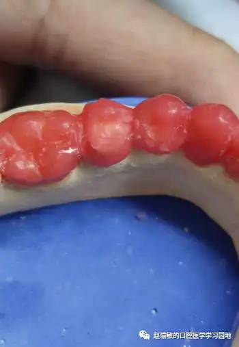 牙体解剖12下颌第二前磨牙