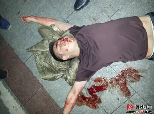 浏阳银天大酒店保安恶性打人致重伤(图)