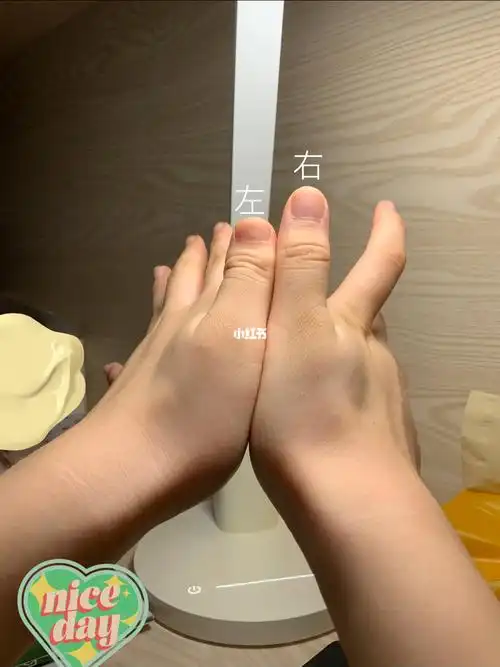 呜呜呜,幼儿园的时候两根手指头的差距只有半个指甲盖,可现在左边应该