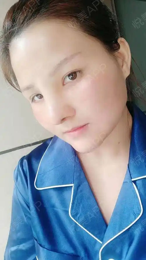 虽然我现在还在恢复期看不出来怎么样,但我很坚信等恢.