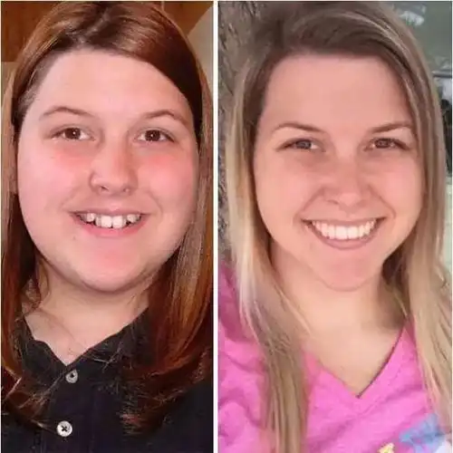 "我只带了不到两年的牙套,但是却有这么大的变化,我要谢谢我的爸爸