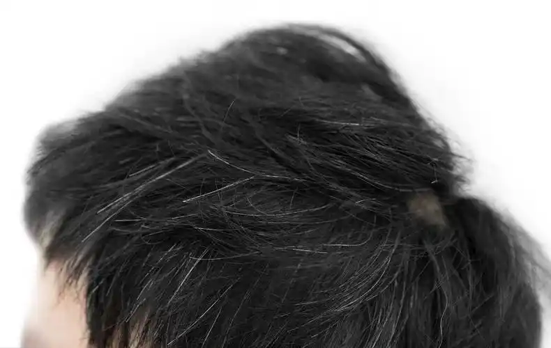 白头发出现的早,是不是意味着寿命比别人短,老得更快?