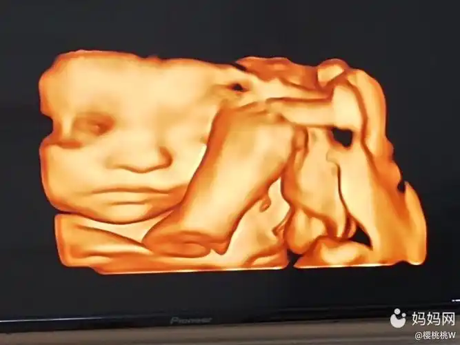 今天做四维彩超小排畸检查,终于看清宝宝的脸了,感觉 | 妈妈网轻聊