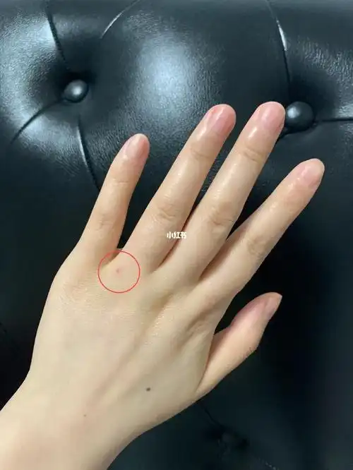 广大友们请问这是朱砂痣吗71