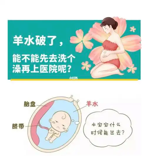 晴分享:羊水破了,能不能洗个澡再去医院呢?