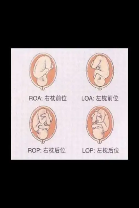roa是什么意思(胎儿b超单上的loa是什么意思)