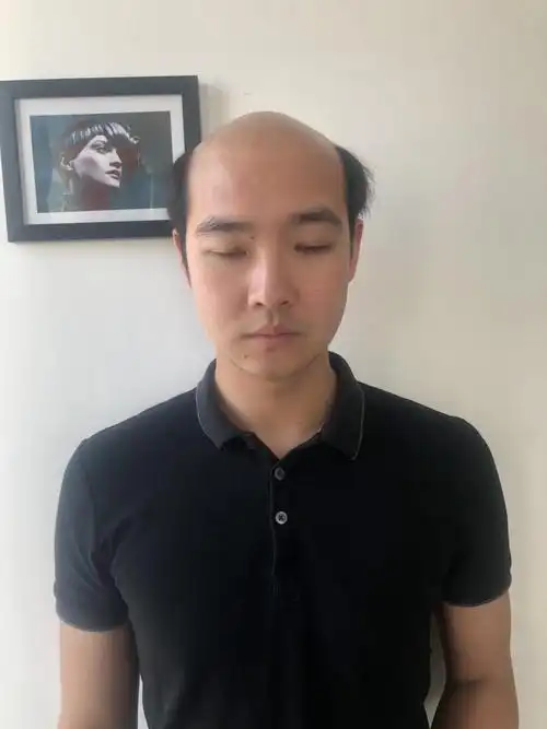 秃顶,谢顶,头发稀少或者是只想改变发型都可以通过织发来解决问题.