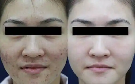 据说皮肤好的女人,颜值都不会太低!