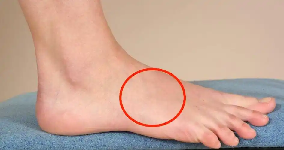 张医生你好我的右脚在前掌左侧如图位置用力比如做提前变相动