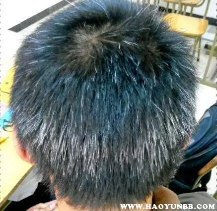 11岁儿童有白头发是缺什么11岁小孩有白头发是什么原因
