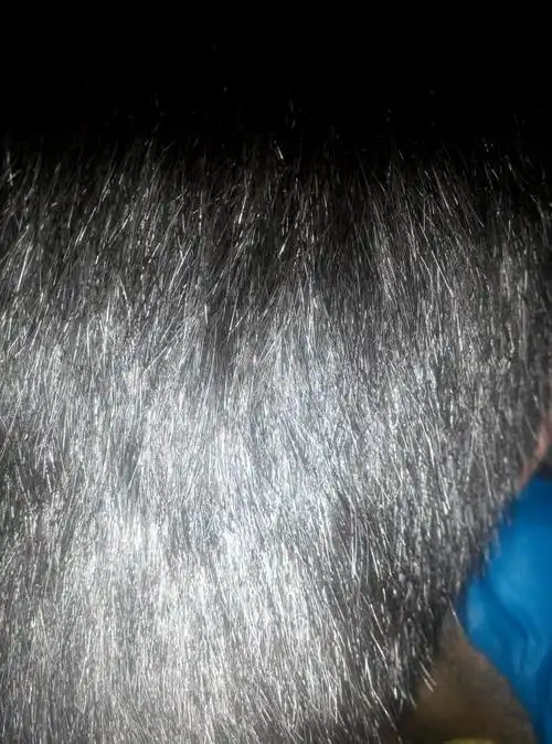 我该怎么办我不会白头偕老吧,不会提前老化吧不会.