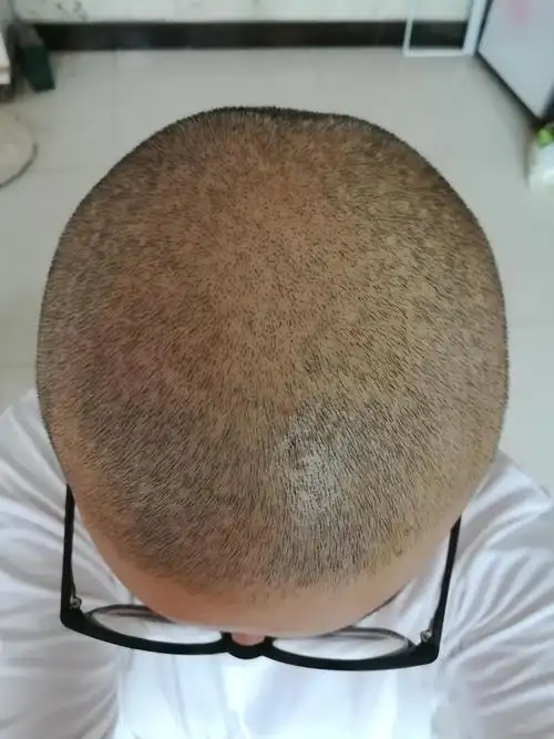 想剃光头妹子的看这里!