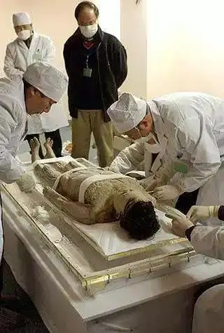 马王堆汉墓出土,辛追夫人尸身被发现后,湘雅医学院教授曾对古尸进行过