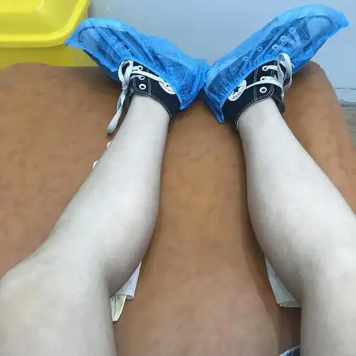 可以看出小腿肚还是很壮滴,我主要是内侧肌肉突出.