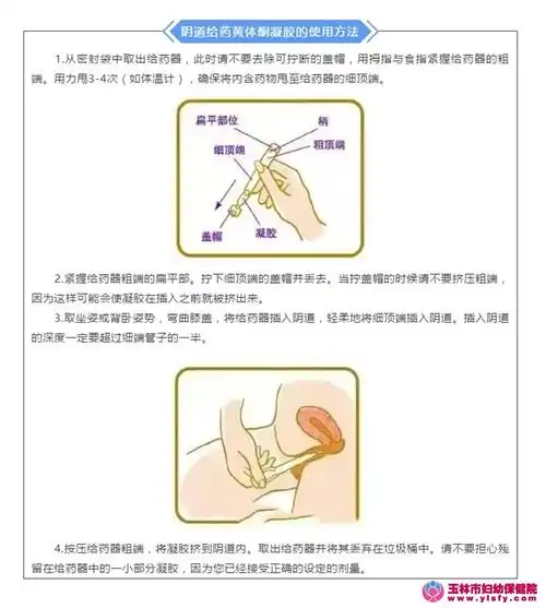 首页 健康教育 > 文章内容   阴道给药的黄体酮是通过提高子宫局部