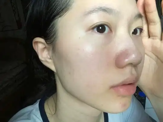 正常人的脸的毛孔图_小红书