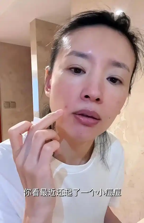 42岁董洁素颜浴室化妆!皮肤过敏脸颊泛红,嘴角长一颗痘太真实