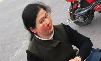 急急!速转:李口高速口女子撞上公交,头部出血,急寻家人!