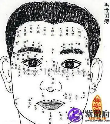 耳部痣相图解耳部痣相图解耳朵上长痣是吉痣,这样的代表着聪明和孝顺