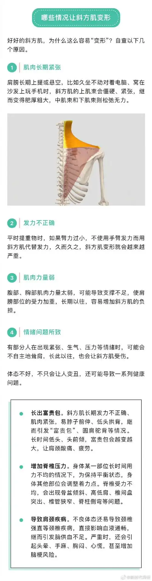 肩颈痛的人多是斜方肌出了问题