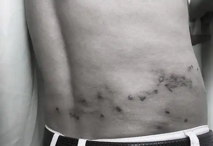 大妈被蛇缠腰在身上画符镇蛇医生拒绝迷信