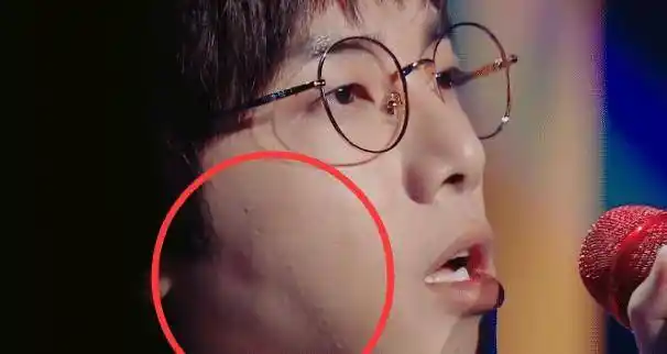 原创华晨宇怼脸拍素颜曝光脸上痘坑痘印众多皮肤状态极差