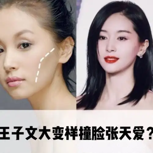 感觉她越来越美了,感觉她做了面部填充,可以看得出来王子文填充之前