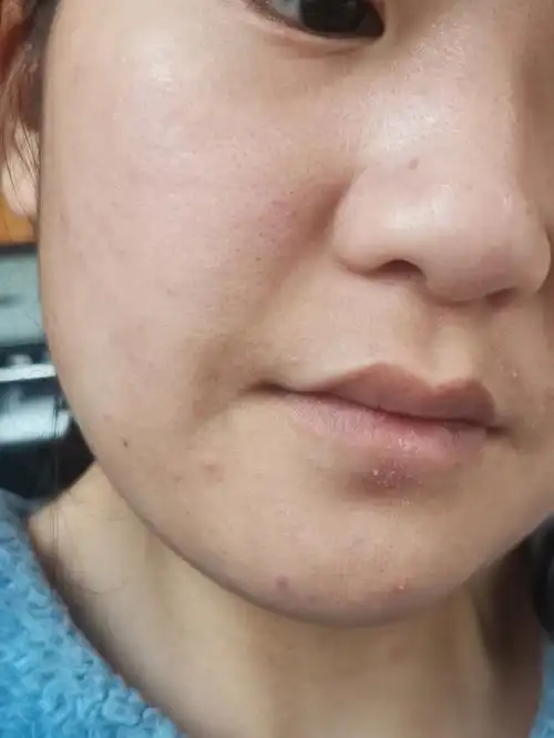 这怕是史上最差皮肤01