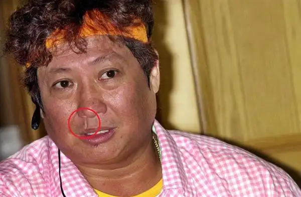 洪金宝嘴上的疤痕怎么来的知情人爆料黑道男星打的