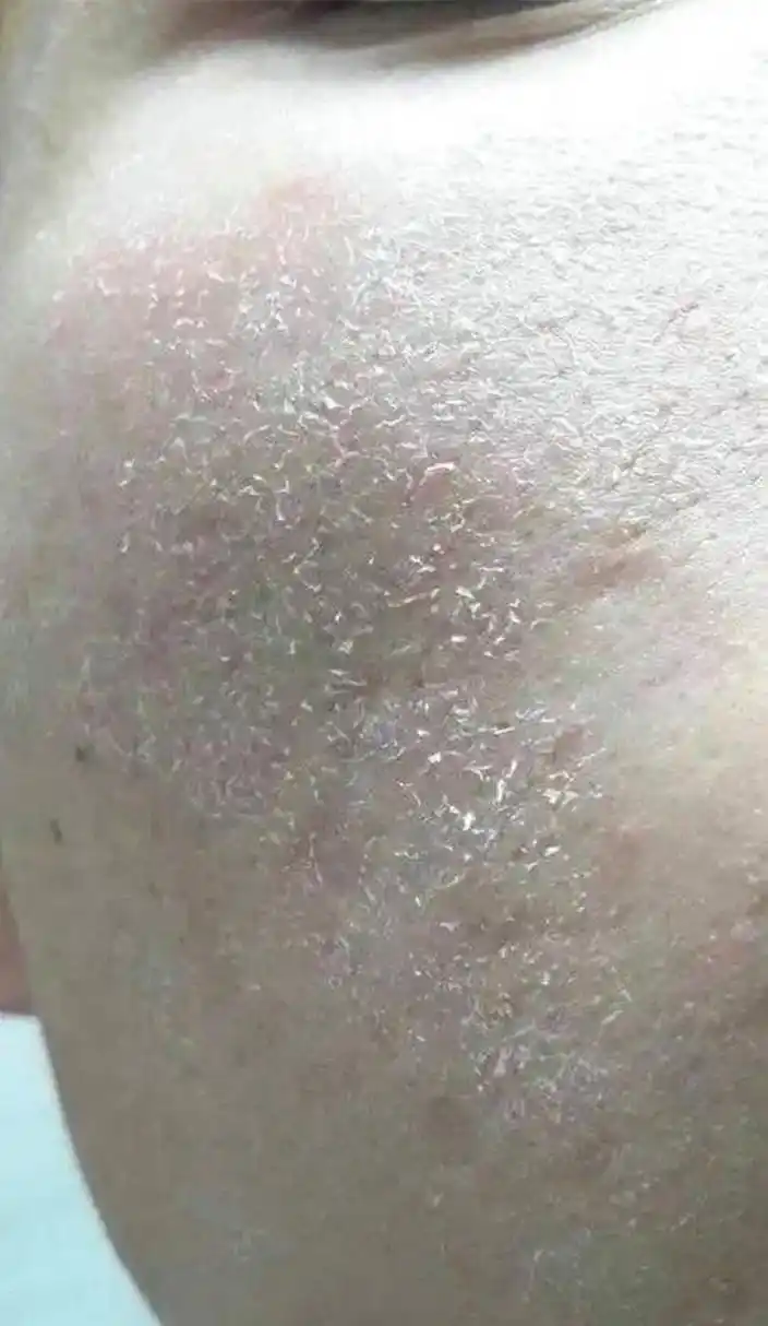 喝水是保湿的直接方法,每天喝充足的水能够让干燥的皮肤看起来更水嫩.