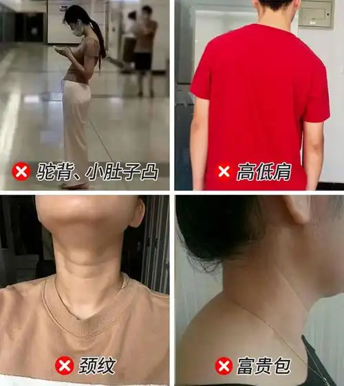 头变轻了,脖子爽了,颈椎越来越舒服|驼背|喉结_网易订阅