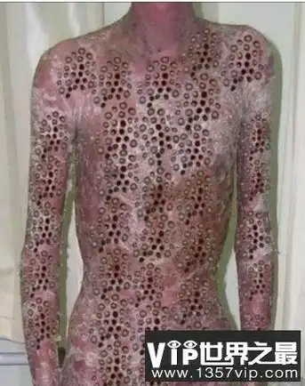 恐怖的玉米男孩图片身上遍布虫洞十分的恶心密集症慎入