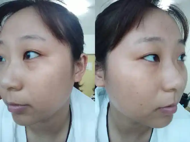 我这个耳朵是外翻的耳朵吗,面相如何